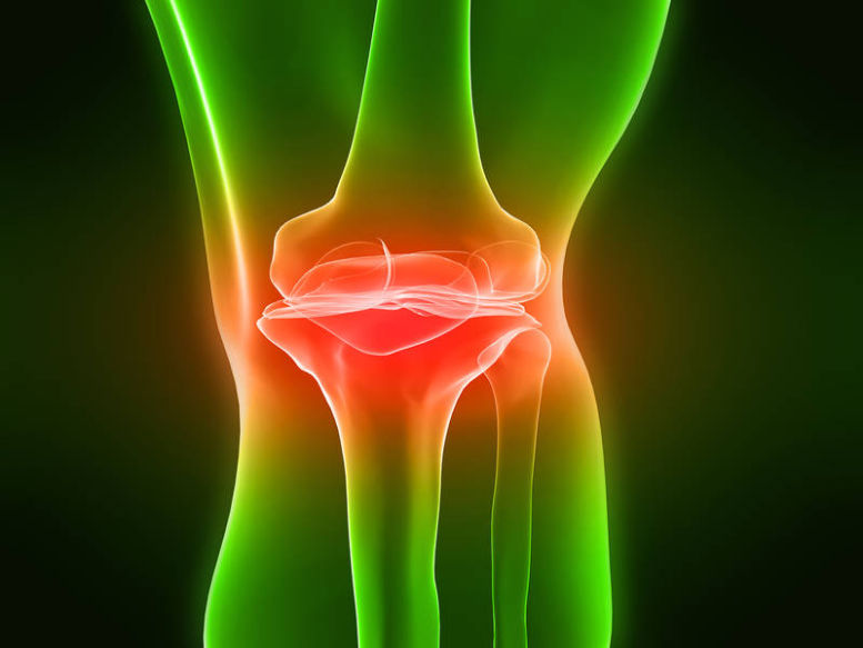 3 cauze ale durerilor de genunchi